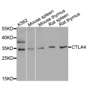 Western blot analysis of extracts of various cell lines, using CTLA4 antibody (abx001680) at 1/1000 dilution.