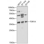 Western blot analysis of extracts of MCF7 (Lane 1), BT-474 (Lane 2), and DU145 (Lane 3) cell lines (25 µg per lane), using TOR1A antibody (1/1000 dilution) followed by HRP-conjugated Goat Anti-Rabbit IgG, H+L (1/10000 dilution) and blocked with 3% non-fat dry milk in TBST.