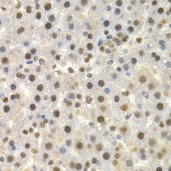 Torsin 1A (TOR1A) Antibody