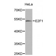 Western blot analysis of extracts of HeLa cells, using E2F1 antibody (abx001684) at 1/1000 dilution.