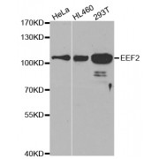 Western blot analysis of extracts of various cell lines, using EEF2 antibody (abx001685) at 1/500 dilution.