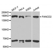 Western blot analysis of extracts of various cell lines, using Fanconi Anemia Group D2 Protein (FANCD2) antibody (abx001687) at 1/1000 dilution.