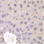 Immunohistochemistry of paraffin-embedded mouse liver using FGFR1 antibody (abx001688) at dilution of 1/100 (40x lens).