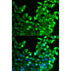 Fibroblast Growth Factor Receptor 2 (FGFR2) Antibody