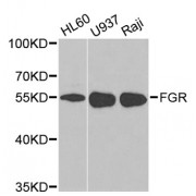 Western blot analysis of extracts of various cell lines, using FGR antibody (abx001690) at 1/1000 dilution.