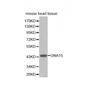 Western blot analysis of extracts of mouse heart, using GNA15 antibody (abx001693).