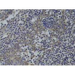 Guanine Nucleotide-Binding Protein Subunit Alpha-15 (GNA15) Antibody