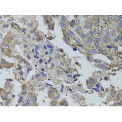 Guanine Nucleotide-Binding Protein Subunit Alpha-15 (GNA15) Antibody