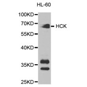 Western blot analysis of extracts of HL-60 cells, using HCK antibody (abx001695) at 1/1000 dilution.