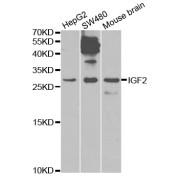 Western blot analysis of extracts of various cell lines, using IGF2 antibody (abx001698) at 1/1000 dilution.