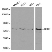 Western blot analysis of extracts of various cell lines, using IKBKB antibody (abx001699) at 1/500 dilution.