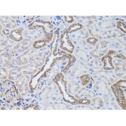 Integrin Alpha V (ITGAV) Antibody
