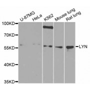 Western blot analysis of extracts of various cell lines, using LYN antibody (abx001705) at 1/1000 dilution.