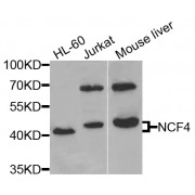 Western blot analysis of extracts of various cell lines, using NCF4 antibody (abx001708) at 1/1000 dilution.