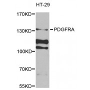 Western blot analysis of extracts of HT-29 cells, using PDGFRA antibody (abx001715) at 1/1000 dilution.