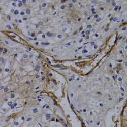 Platelet And Endothelial Cell Adhesion Molecule 1 (PECAM1) Antibody
