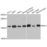 Western blot analysis of extracts of various cell lines, using PIN1 antibody (abx001718) at 1/1000 dilution.