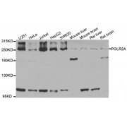 Western blot analysis of extracts of various cell lines, using POLR2A antibody (abx001719) at 1/1000 dilution.