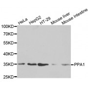 Western blot analysis of extracts of various cell lines, using PPA1 antibody (abx001720) at 1/1000 dilution.