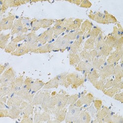 Inorganic Pyrophosphatase (PPA1) Antibody