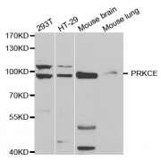 Western blot analysis of extracts of various cell lines, using PRKCE antibody (abx001722) at 1/500 dilution.