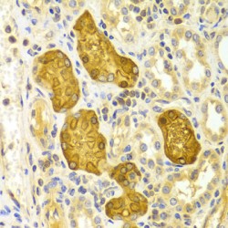 Protein Kinase C Epsilon (PRKCE) Antibody