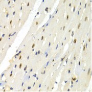 Immunohistochemistry of paraffin-embedded rat heart using PTEN antibody (abx001725) at dilution of 1/200 (40x lens).