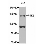 Western blot analysis of extracts of HeLa cells, using PTK2 antibody (abx001726) at 1/1000 dilution.