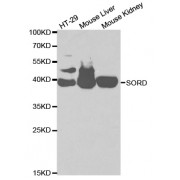 Western blot analysis of extracts of various cell lines, using SORD antibody (abx001730) at 1/1000 dilution.