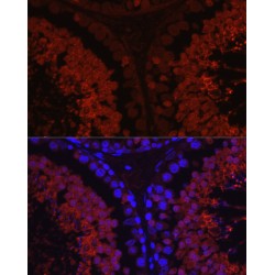 Hyaluronidase PH-20 (SPAM1) Antibody