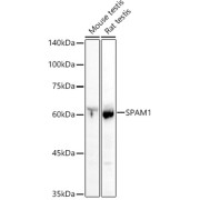 WB analysis of extracts of various cell lines, using SPAM1 antibody (abx001732) at 1/1000 dilution.