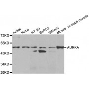 Western blot analysis of extracts of various cell lines, using AURKA antibody (abx001733) at 1/1000 dilution.