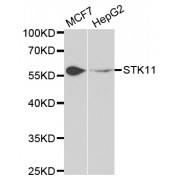 Western blot analysis of extracts of various cell lines, using STK11 antibody (abx001734) at 1/1000 dilution.
