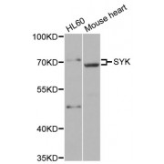 Western blot analysis of extracts of various cell lines, using SYK antibody (abx001735) at 1/500 dilution.