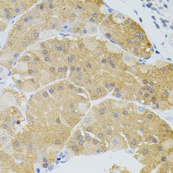Spleen Associated Tyrosine Kinase (SYK) Antibody