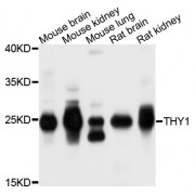 Western blot analysis of extracts of various cell lines, using THY1 antibody (abx001738) at 1/1000 dilution.