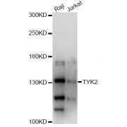Western blot analysis of extracts of various cell lines, using TYK2 antibody (abx001740) at 1/1000 dilution.