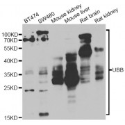 Western blot analysis of extracts of various cell lines, using UBB antibody (abx001741) at 1/1000 dilution.