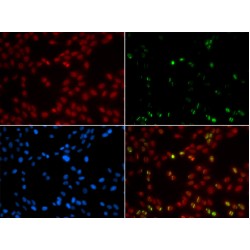 Small Ubiquitin Related Modifier Protein 1 (SUMO1) Antibody