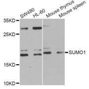 Western blot analysis of extracts of various cell lines, using SUMO1 Antibody (abx001742) at 1/1000 dilution.
