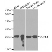 Western blot analysis of extracts of various cell lines, using UCHL1 antibody (abx001743) at 1/1000 dilution.