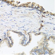 Immunohistochemistry of paraffin-embedded human prostate using Wnt5a antibody (abx001745) at dilution of 1/100 (40x lens).