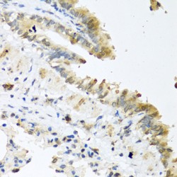 Protein Wnt-5a (Wnt5a) Antibody