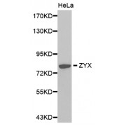 Western blot analysis of extracts of HeLa cells, using ZYX antibody (abx001747).