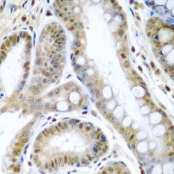 Tumor Necrosis Factor Ligand Superfamily Member 10 / TRAIL (TNFSF10) Antibody