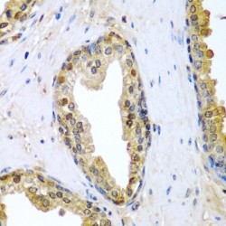 Tumor Necrosis Factor Ligand Superfamily Member 10 / TRAIL (TNFSF10) Antibody