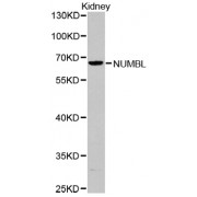 Western blot analysis of extracts of Kidney cells, using NUMBL antibody (abx001752).