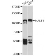 Western blot analysis of extracts of various cell lines, using MALT1 antibody (abx001756) at 1/1000 dilution.