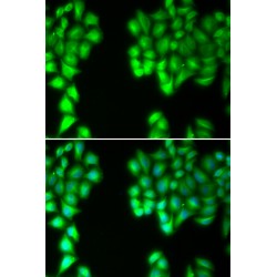 Mucosa-Associated Lymphoid Tissue Lymphoma Translocation Protein 1 (MALT1) Antibody
