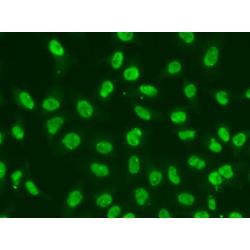 Checkpoint Kinase 2 (CHEK2) Antibody